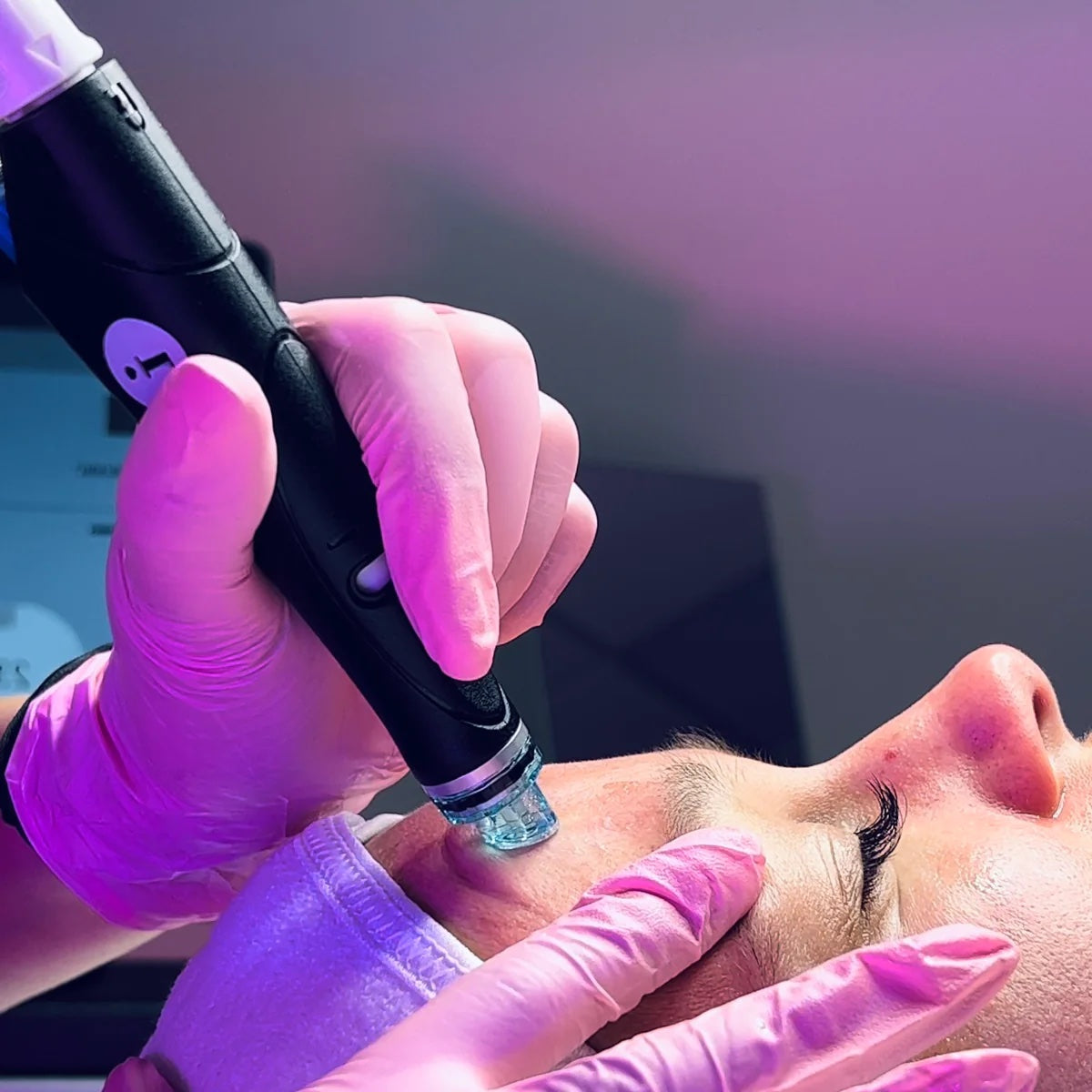 HydraFacial Sale