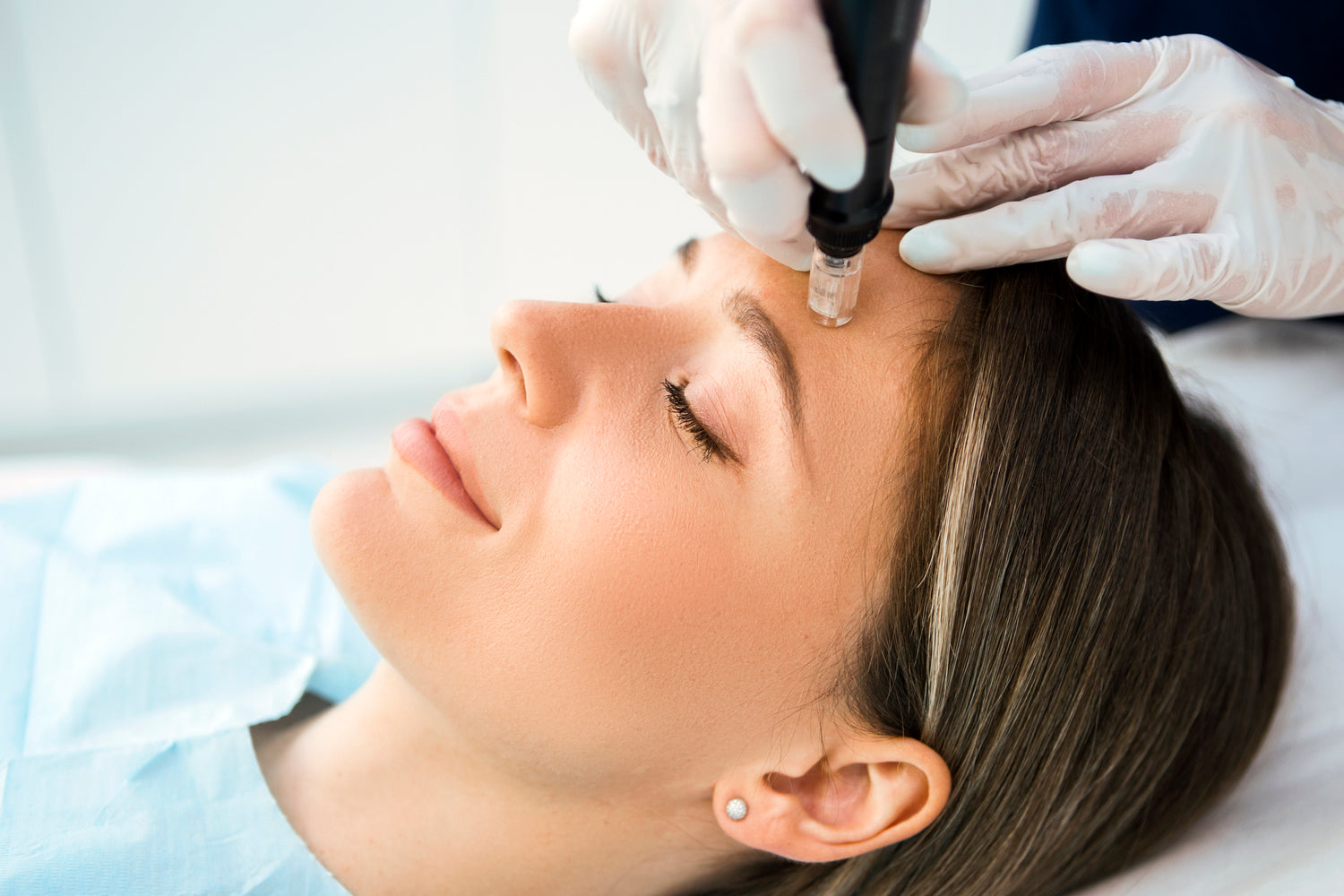 Derma Pen Microneedling Transformation Medispa TX