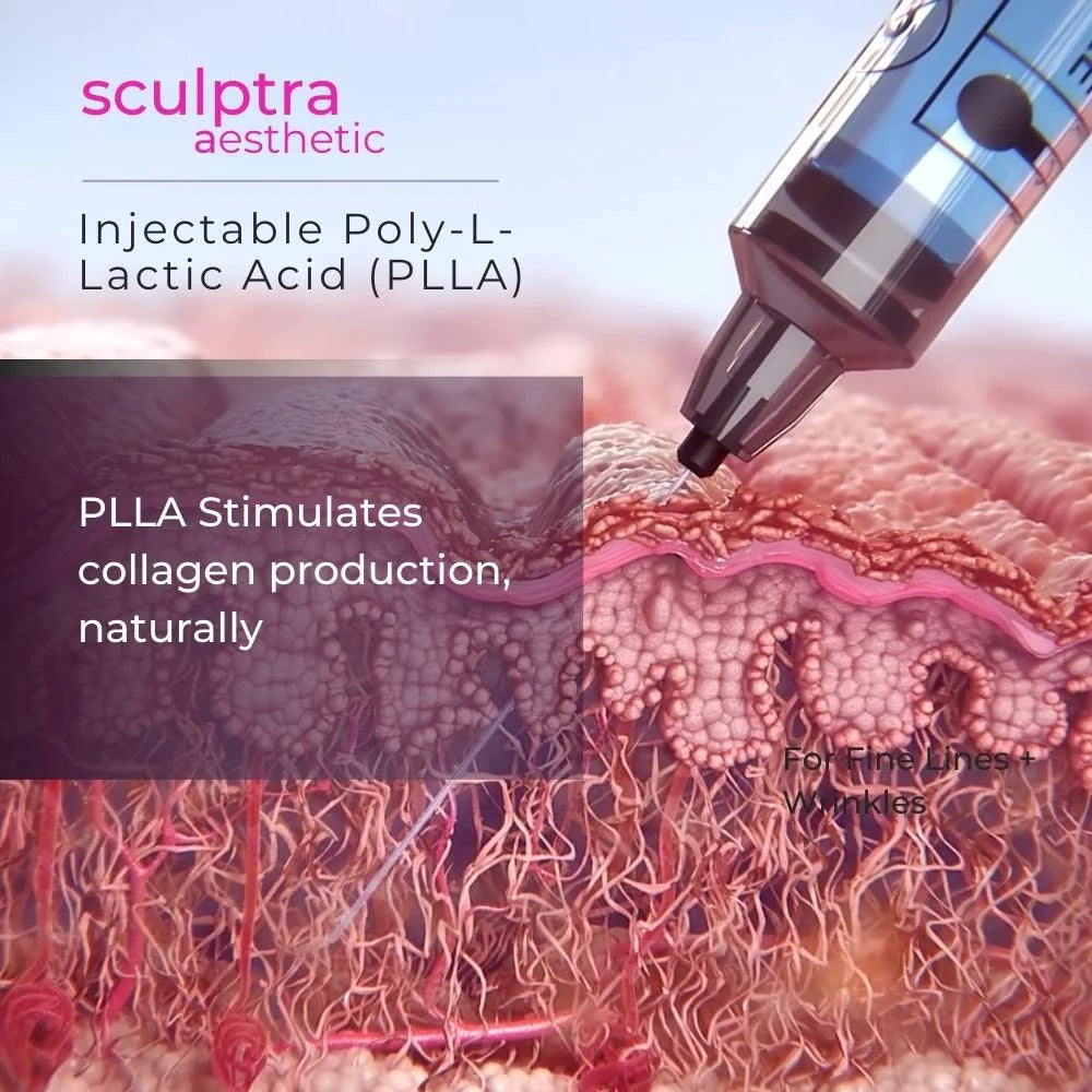 Sculptra Sale!